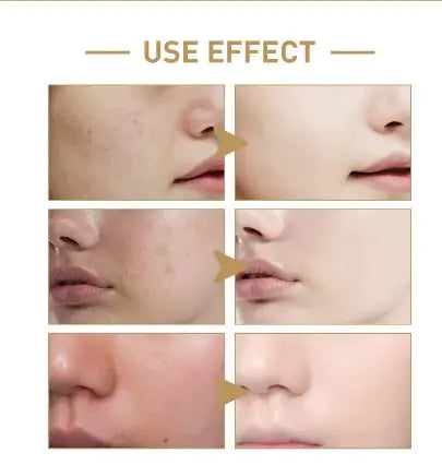 Rice Face Toner - Hydrating & Moisturizing Formula